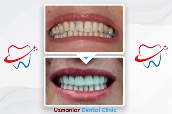 Slider image (6) Uzmanlar Dental Clinic